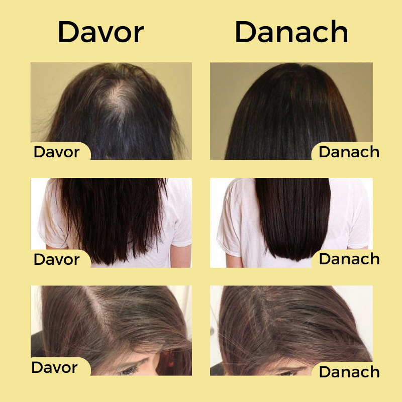 Nolena - Natürliches Haaröl zum Haarwachstum beschleunigen!